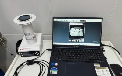hospital do Mocambinho passa a realizar Raio-X odontológico