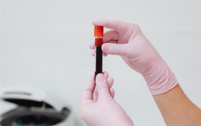 Fala SBCD destaca a importância da doação de sangue em episódio especial do Junho Vermelho