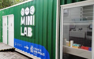 UPA Jaçanã libera resultados de exames em menos de 60 minutos com minilaboratório